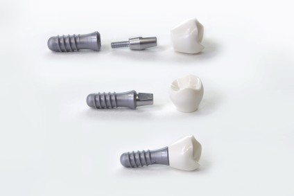 Zahnarztpraxis Dr. Mesut Cosgun - Leistungen Implantate