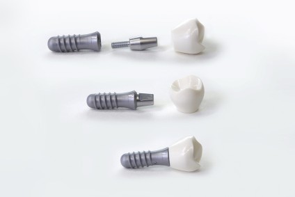 Implantate - Leistungen der Zahnarztpraxis confident Dr. Mesut Cosgun Kieferknochen Titan Zahnimplantat