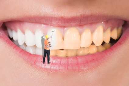 Zahnaufhellung (Bleaching) - Leistungen der Zahnarztpraxis confident Dr. Mesut Cosgun - aufhellen Bleachen Zähne Lächeln Attraktivität Lebensfreude Wasserstoffperoxid Homebleaching